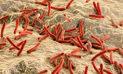 Mycobacterium Leprae 